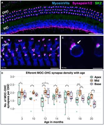 Age-related alterations in efferent medial olivocochlear-outer hair cell and primary auditory ribbon synapses in CBA/J mice